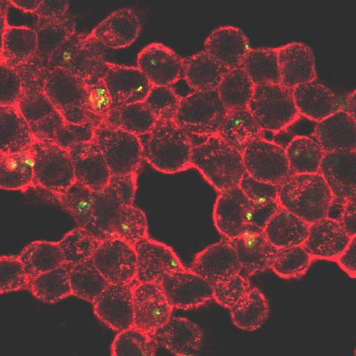 Macrófagos con filamentos de actina y Rhodococcus equi intracelular